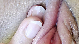 A Swollen Clitoris Looks Even Fleshier up Close