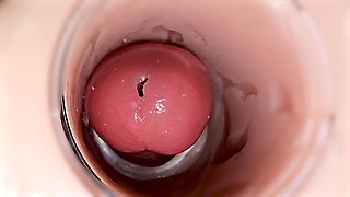 Camera Inside Deep Pussy Captures Huge Ejaculation of Sperm