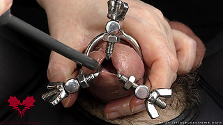 Dilation of the Hole Expanded Glans and Sperm Blockage Through Urethral Insertion of the Finger - Closeup