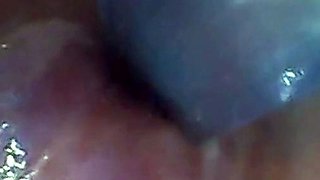 Endoscope POV: Test Tube Cock Urethral Insertion