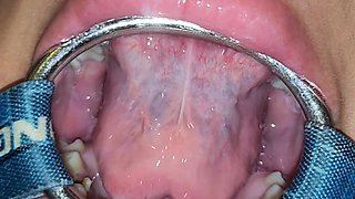 Putting It in Her Pussy and Then Straight Into Her Mouth with a Spider Gag in Her Open Mouth