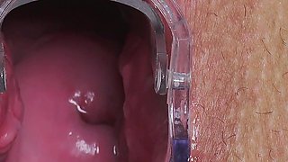 Horny Blonde with Big Meaty Pussy Fingered by Doctor