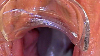 Mature Pussz Examined in Gyno Office