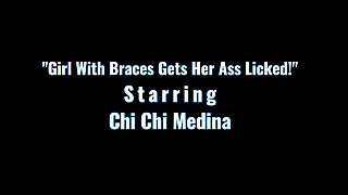 Girl with Braces Gets Her Ass Licked! Allanalallthetime