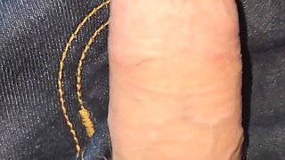 Gaping Urethra - Marker and Pinky Insertion