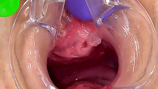 Beautiful Teen Gets Anal Orgasm with a Speculum Inside Her Pussy