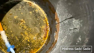 A Simple Catheter Demonstration, Widen His Urethra