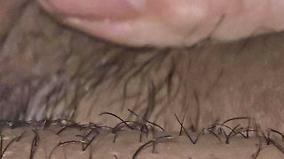 Step son couldn't take care of his erection with broken arm so he asked step mom a handjob