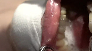 Spit and More Spit! Let Me Just Cover You!