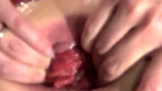 Fisting and extreme belly bulging